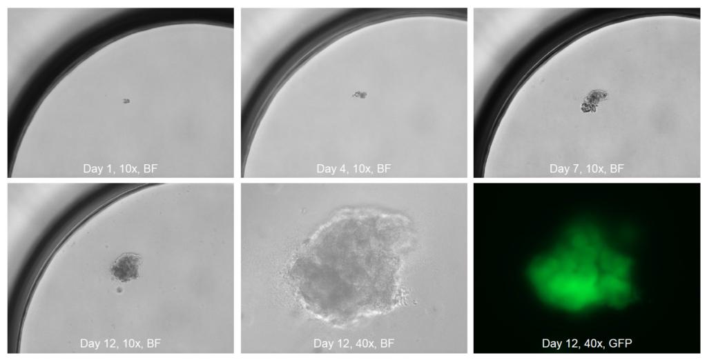 1CellAssay 3D Culture SCSCP シングルセル由来スフェロイド　クローン　スクリーニング ３次元細胞培養 MDA-MB-231/GFP 乳がん細胞